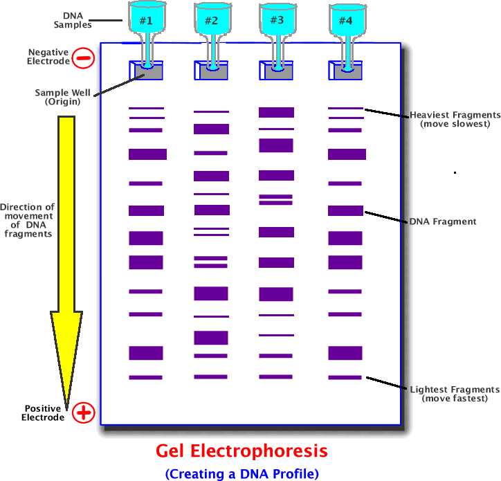 Gel Electrophoresis 0558